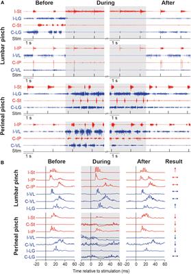 Inhibition and Facilitation of the Spinal Locomotor Central Pattern Generator and Reflex Circuits by Somatosensory Feedback From the Lumbar and Perineal Regions After Spinal Cord Injury